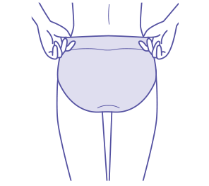 ショーツ・ショーツガードル